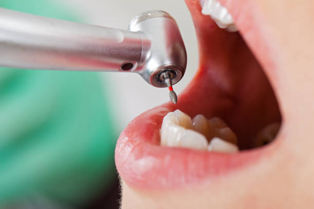 Best Weekend Emergency Dentist in Daisetta, TX